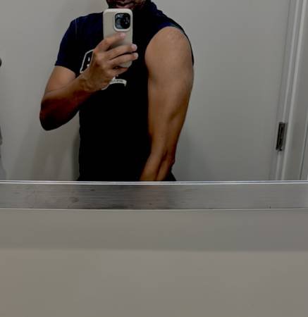 Professional Acupuncture Therapy in Toronto with Registered Acupuncturist