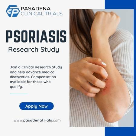Earn for Paid Participation – Psoriasis Clinical Study (Pasadena)