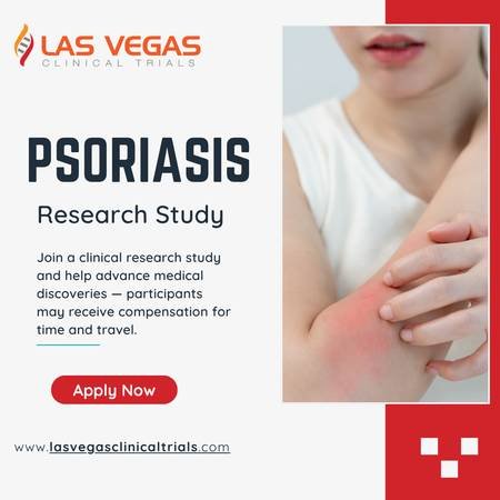 Earn Money for Paid Participation in a Psoriasis Clinical Study in North Las Vegas